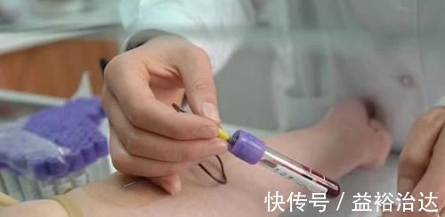 胎儿|四维彩超是什么?四位彩超可以看出胎儿是唐氏儿吗?