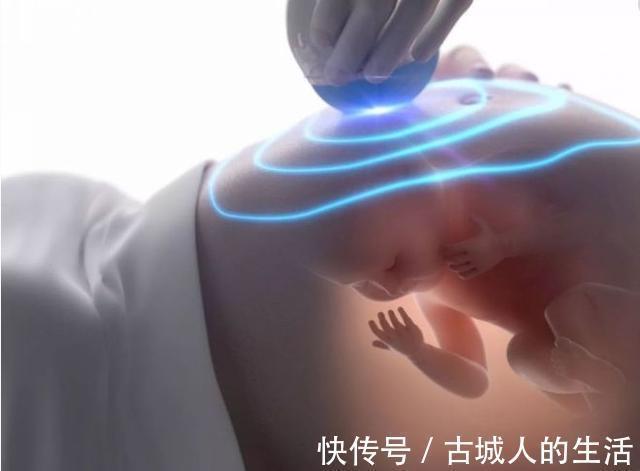 小情人|产检单上如果出现3个“信息”迎接准爸“小情人”吧,赶快看一下