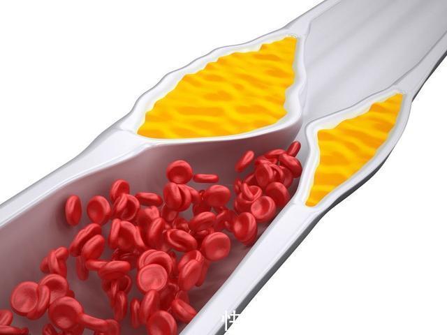 脂肪含量|过年吃鱼避开这4种,或是甲醛和重金属“携带者”,看完转给家人