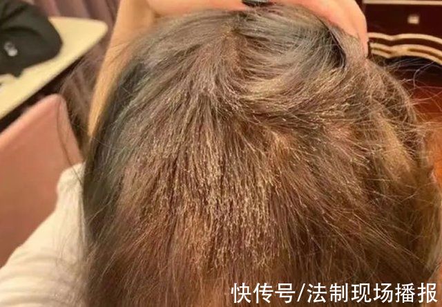 管女士 “我丑得出不了门!”女大学生花1000块染发变成这副模样:赔我20万