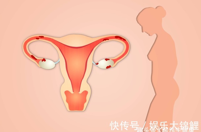 营养物质|医生提醒：女人更年期后，少吃这3样食物，或能远离“黄脸婆”