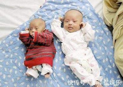 差别|双胞胎出生后，一个吃母乳，一个喝奶粉，5个月后差别不是一般大