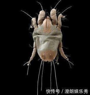 除螨|你可能已被“寄生虫”包围,有的在你脸上打洞,还有的住在毛囊里