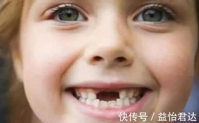 牙齿|孩子12岁前必须处理的牙齿问题!家长都了解吗?
