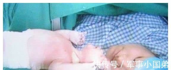 胎儿|怀孕37周把胎儿剖出来,结果宝宝出生后不久,宝妈就开始悔