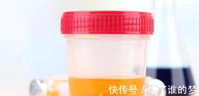 排出体外|肾不好的人，身体可能有“1黑2臭”，若你全没有，恭喜肾还不错！