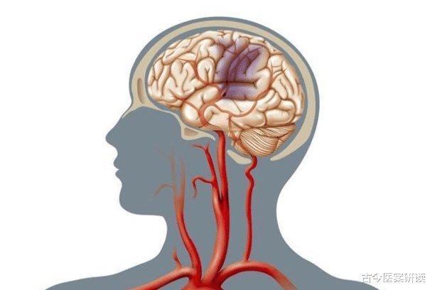 蘑菇|脑供血不足很怕“1黄”,不是玉米,你若常吃,疏通血管,手脚不麻头不晕!