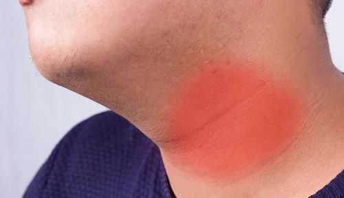 中年|有结节的人,甲状腺想让你“拉黑”的食物,再喜欢也少往嘴里送