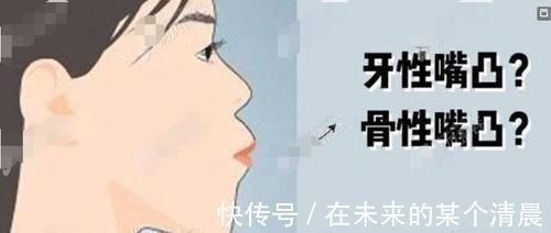 嘴唇|长期抿嘴会改善凸嘴吗我经常用嘴呼吸导致上嘴唇前突了