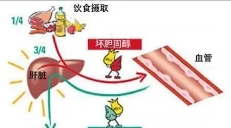 胆固醇|为什么每天坚持运动锻炼,可是血脂就是降不下来?医生告诉您实情