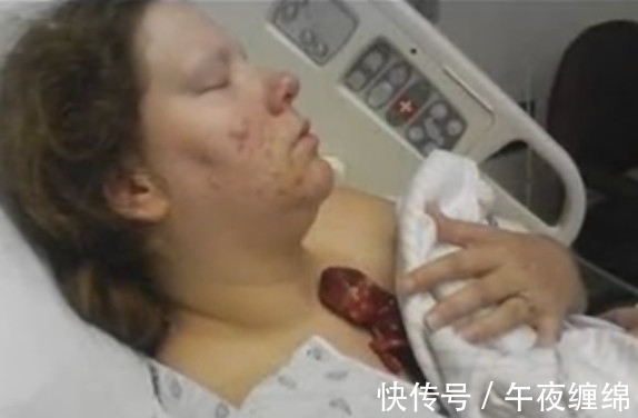 女子|女子生下3指大的婴儿,让在场所有医护人员都震惊了