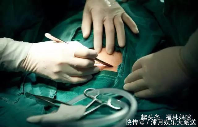 产妇|剖腹产会划伤孩子吗避免划伤宝宝,孕期和生产时要注意5点