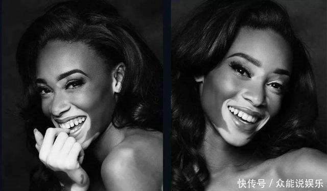 泰勒|奇闻:女子孕检是双胞胎,10个月后生下一个双色婴儿,嵌合体?