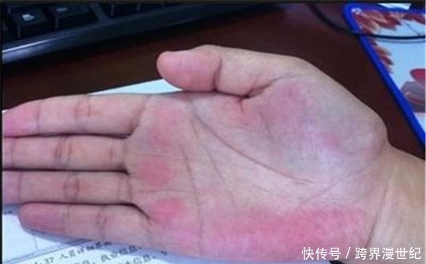 现了问题|养肝就是养命,肝不好会有4点表现,如果没有说明肝是健康的