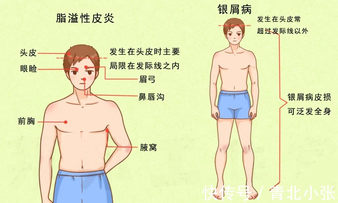 关注您的肌肤健康——西宁青北皮肤医院