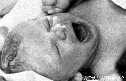 技术|“试管婴儿”的寿命,真的和正常婴儿一样么没想过答案是这样!