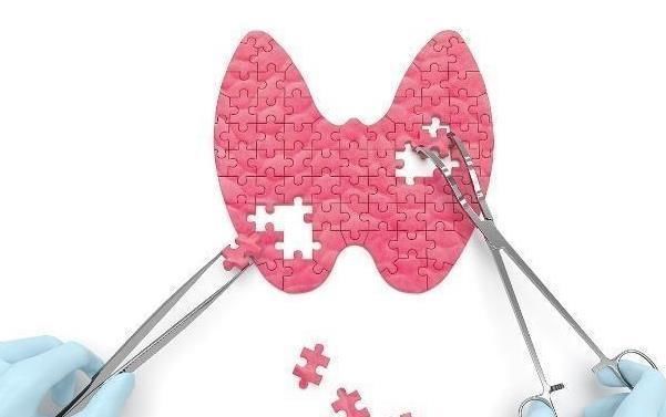 甲状腺有结节,远离2个“诱因”,记得“1多1按