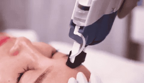 水光|水光针只能补水吗?还有什么功效?丨科普篇