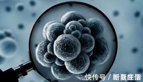 癌细胞|甲状腺癌做了手术容易复发吗?做好这3点,防止癌细胞卷土重来