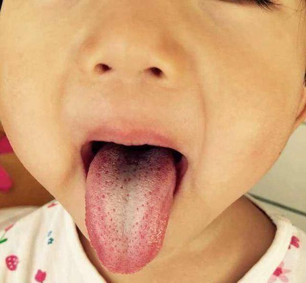 积食|6岁男孩患上侏儒症,医生别再给孩子灌毒汤,否则不配做家长