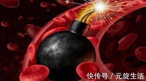 净化|血管堵了不用慌, 每天吃点“它”, 帮你净化血管, 清走血栓