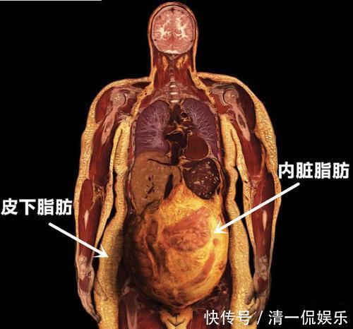 宿便|为什么四肢不胖，却出现肚腩罪魁祸首有4个