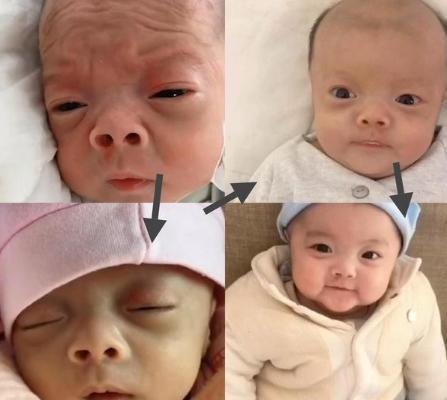 逆袭|当年“丑哭宝妈”的宝宝,逆袭的太彻底了,宝妈:还好当初没扔