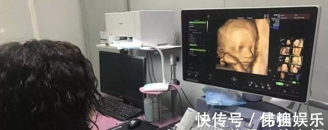 胎儿|4种可能让宝宝“变畸形”的食物,孕妈妈再爱也别碰!