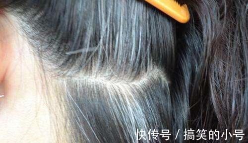 头发|如何做能让白发来得晚一些?除了遗传,有3点我们是可以控制的