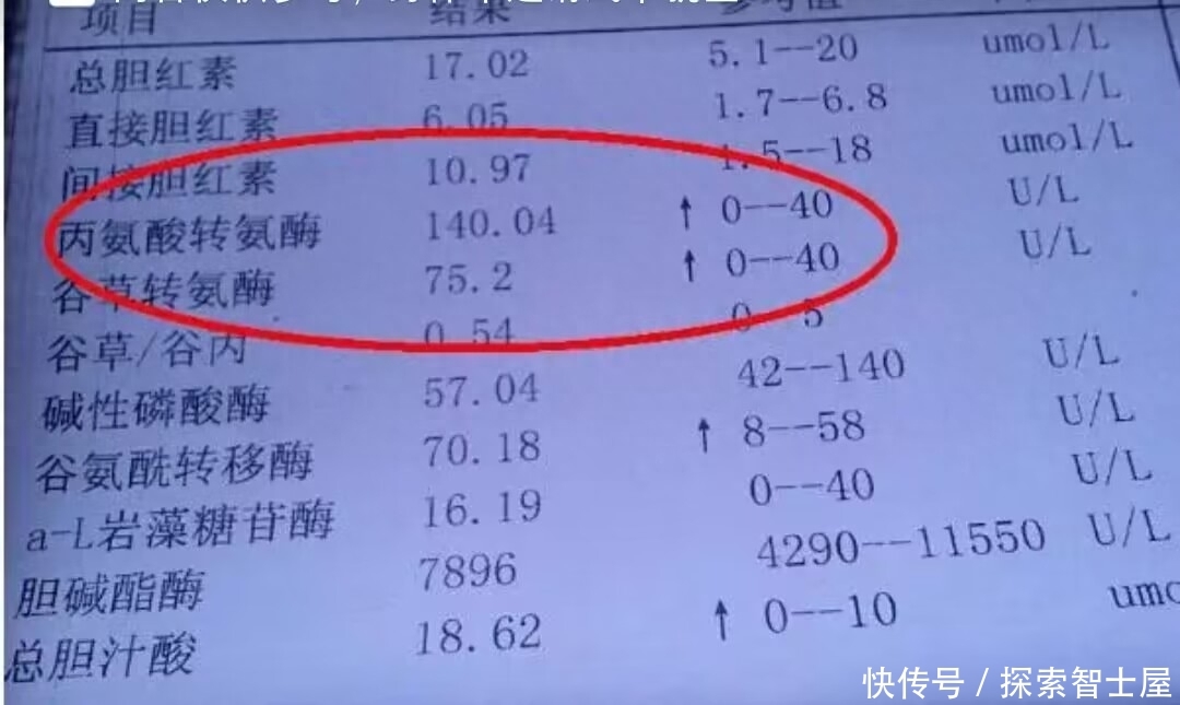 转氨酶比值2.4