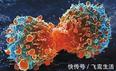 舌苔|学会看自己的舌像,有些癌症或许就能早发现!