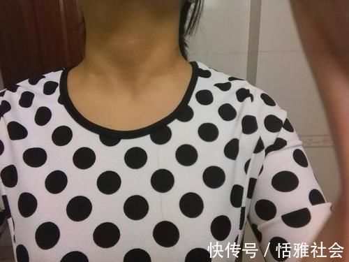 脖子|癌症早期有什么症状？如何才能早发现？