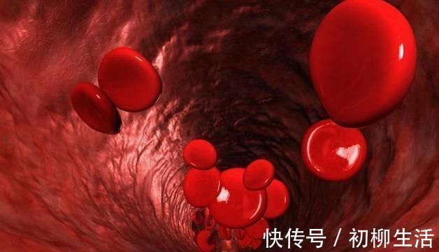 血栓|出现4个表现,血液已太粘稠!防血栓,谨记饭后三忌,睡前三不宜