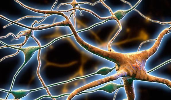 老人|很火的老年痴呆测试图只看到2个人要小心了，再拖真“呆”了