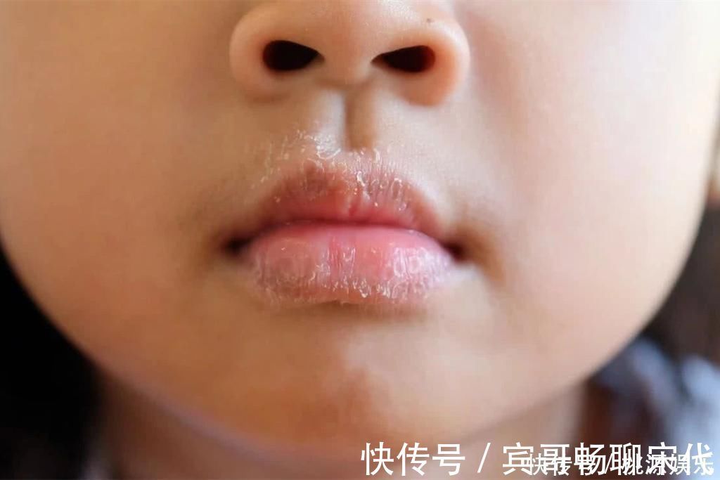 嘴唇|因为1个习惯动作,5岁男童被抽血4次,这个安全隐患宝妈快自查