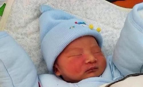 遗传|胎记是怎么来的产科医生除了遗传,孕期的这3种行为注意避开