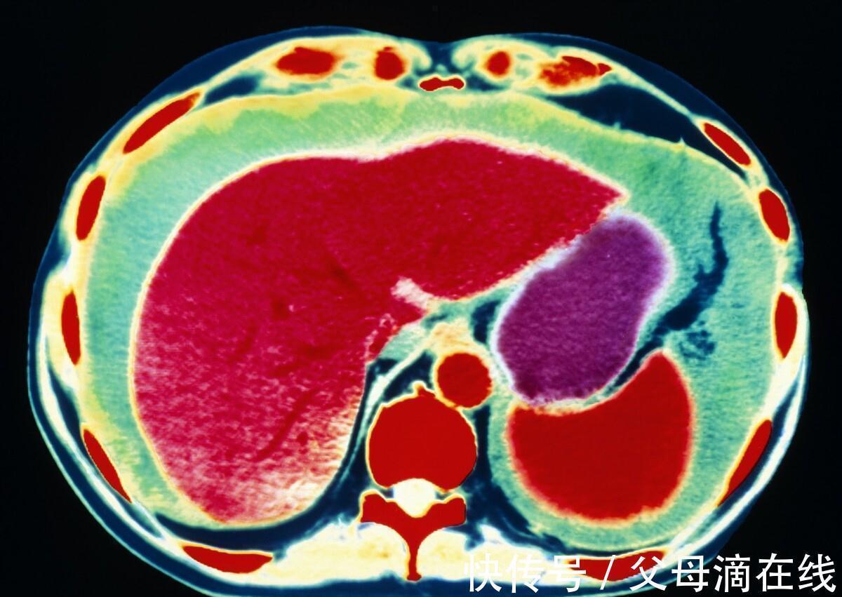 治疗|又一抗癌杀招出现,利于高温“烫死”癌细胞!可以治疗多种癌症