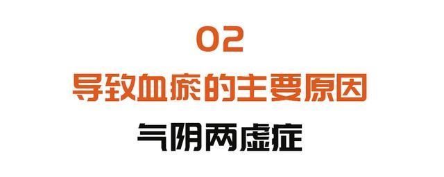 活血|一表自测血瘀体质，面色不好的人都该看看！两个调理方，帮您益气活血