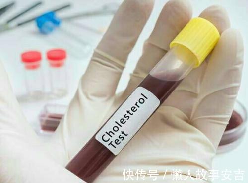 血管內皮|腿部若有3處異常，多半是血脂超標，4件事要常做