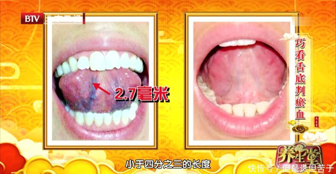  草红花|91岁老中医，每天吃五宝50年！活血化瘀，增强免疫力，人人可学