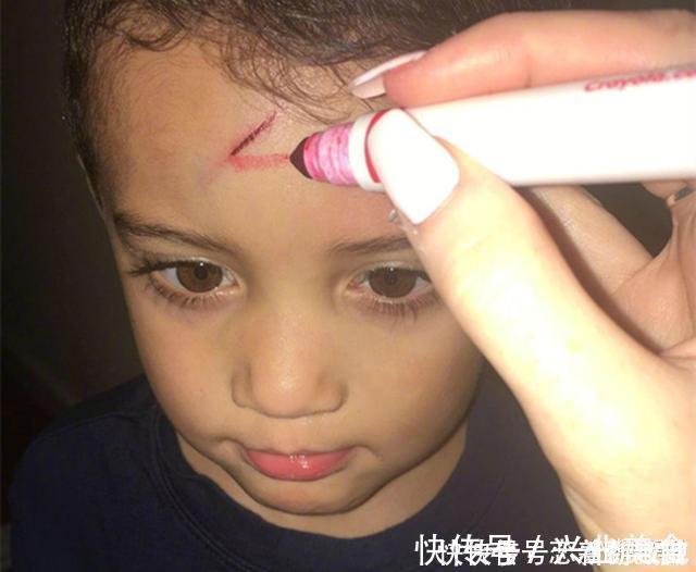 宝妈|男孩不小心磕破了额头,宝妈灵机一动,让娃变成了“哈利波特”