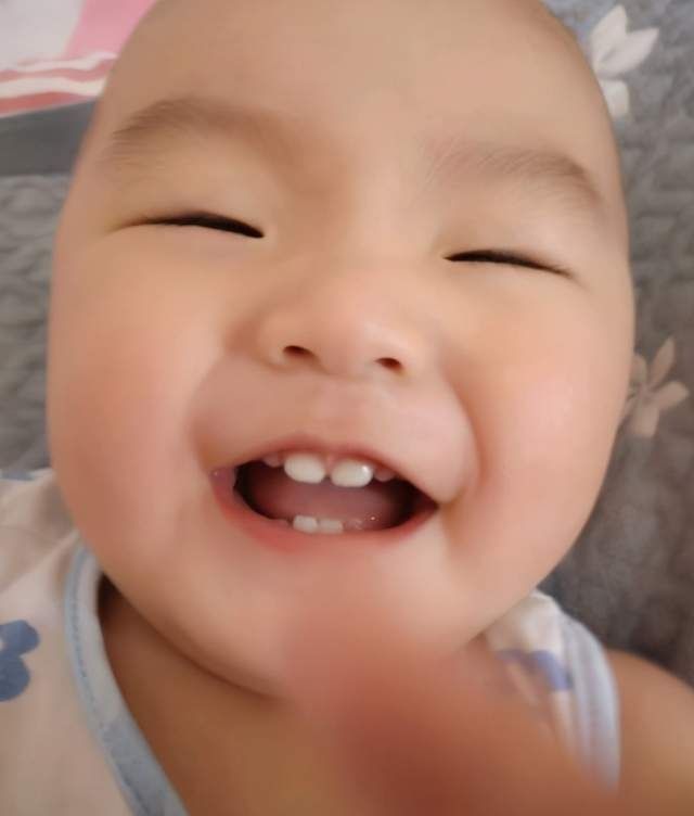 医生|宝宝一出生就有两颗牙齿,宝妈满心欢喜,医生却泼冷水:拔掉吧
