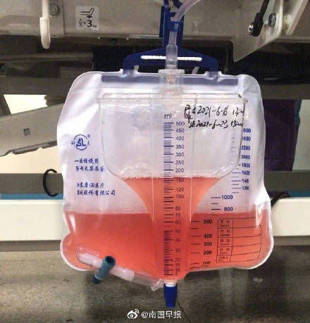 母亲|广西一母亲捐肾挽救患病女儿