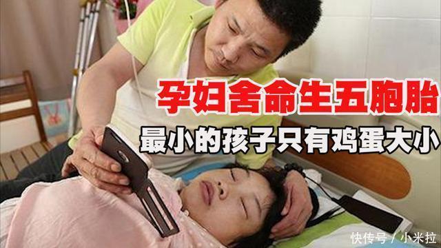 手术|孕妇产下五胞胎,最小的宝宝只有鸡蛋大,网友:她超额完成任务