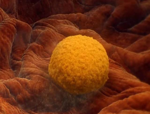 真的|“空孕囊”真的只有胎停育一种结果吗？也许还有另一种结果……