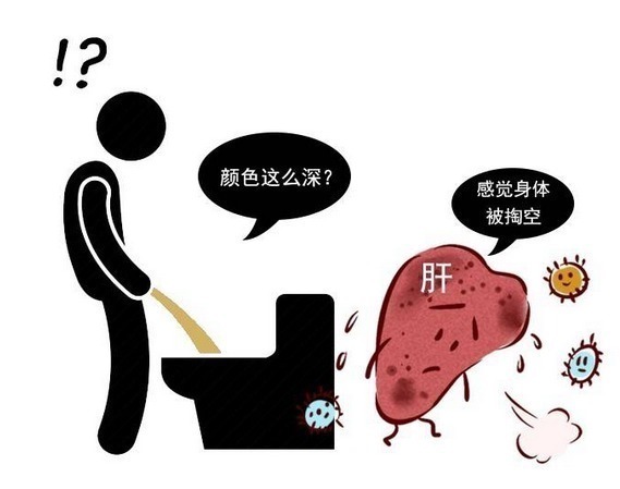酒精肝|肝不好，上厕所时会有4个反常，很容易看出来，希望你没有