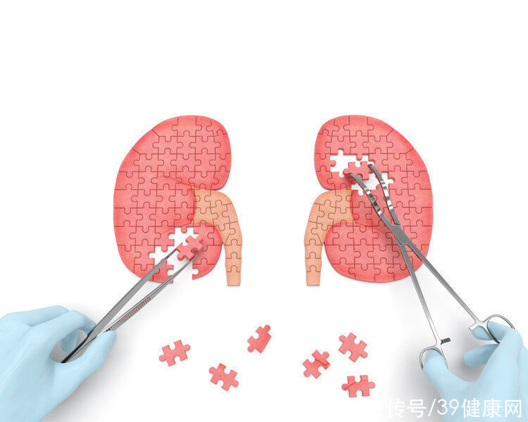 常见的结石|肾结石、胆结石、膀胱结石，到底要不要开刀手术？一篇文章说清了