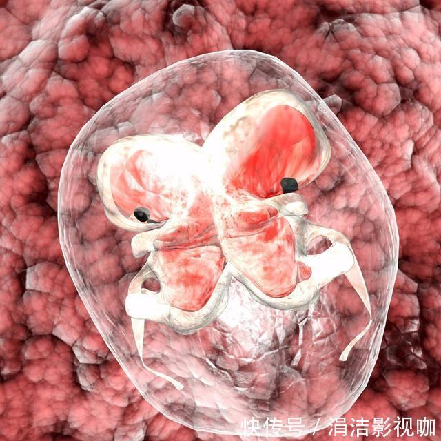 寄生胎|男婴一出生肚子圆如鼓，7天后剖腹，“生”下一个四肢完整胎儿