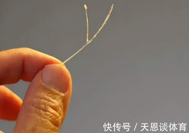 家长们|四岁女儿被鱼刺卡喉,家长用机智救了娃,医生:优秀的父母