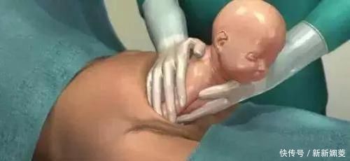 妈妈|剖腹产到底是怎么“剖”的一组图看清全过程,每个妈妈都是超人